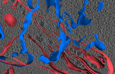 Cryo-electron tomography (cryoET)