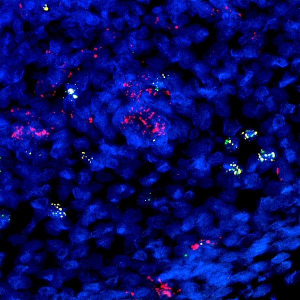 Developing B cells in prenatal gut2 credit Chenqu Suo, Sophie Pritchard & Nadav Yayon for the Wellcome Sanger Institute - Sarah Teichmann