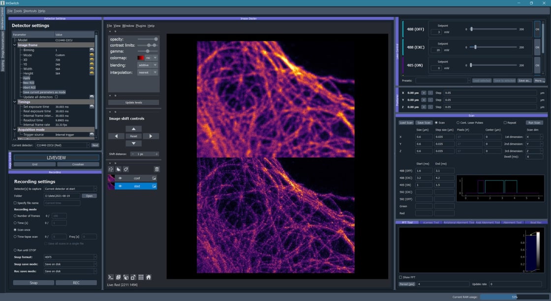 Visualization of single-cell tracks from time lapse microscopy data. Image provided by Alan Lowe.