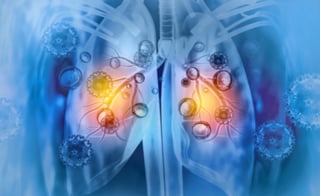 Lung Microbiome Marrow Transplant