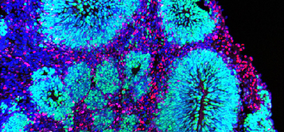 Cortical organoid - Arnold Kriegstein