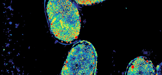 Embryo Computational Microscopy - Shwetadwip Chowdhury