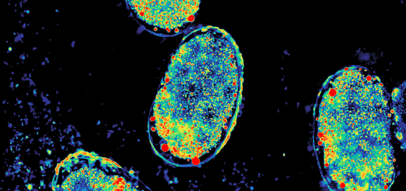 Image of embryo using computational microscopy, courtesy of Shwetadwip Showdhury